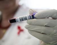 В области снизилась заболеваемость ВИЧ-инфекцией